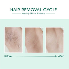 PureSilk IPL Hair Remover